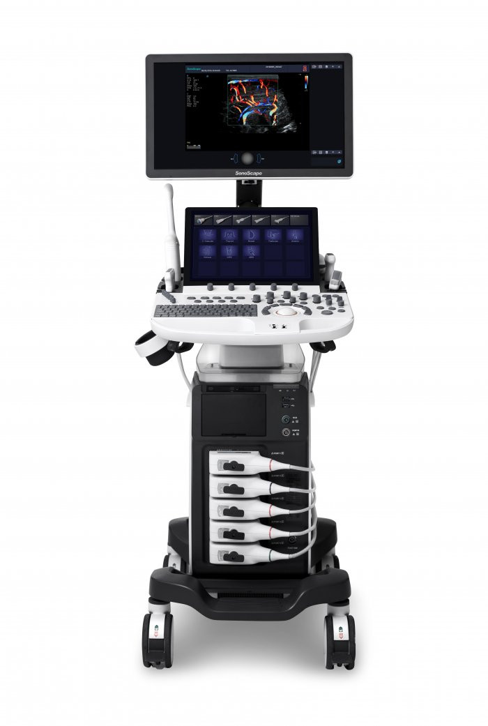 SonoScape P40Elite (ВЕТ) - фото - 2